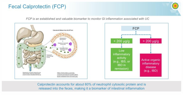 Calprotectin 분석 이미지 01